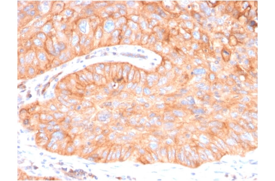 Immunohistochemistry - Anti-CD73 Antibody [NT5E/2646] (A249539) - Antibodies.com