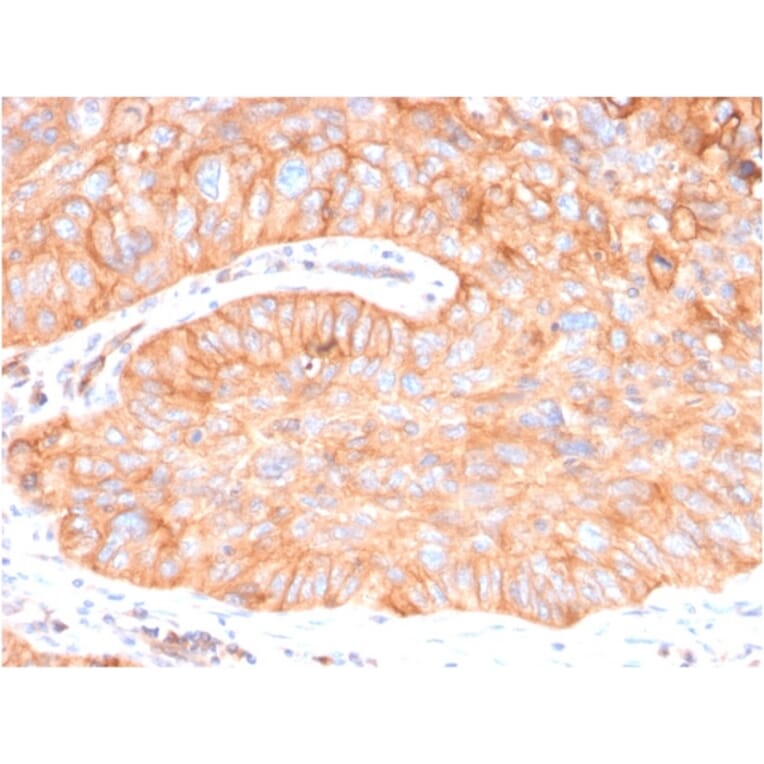 Immunohistochemistry - Anti-CD73 Antibody [NT5E/2646] (A249539) - Antibodies.com