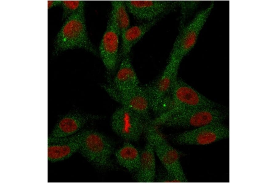 Immunofluorescence - Anti-CD73 Antibody [NT5E/2646] (A249539) - Antibodies.com