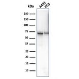 Western Blot - Anti-CD73 Antibody [NT5E/2646] (A249539) - Antibodies.com