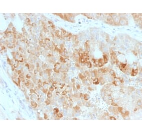 Immunohistochemistry - Anti-ROR2 Antibody [ROR2/1911] (A249539) - Antibodies.com