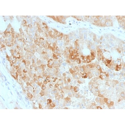 Immunohistochemistry - Anti-ROR2 Antibody [ROR2/1911] (A249539) - Antibodies.com