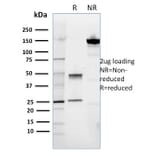 SDS-PAGE - Anti-ROR2 Antibody [ROR2/1911] (A249540) - Antibodies.com