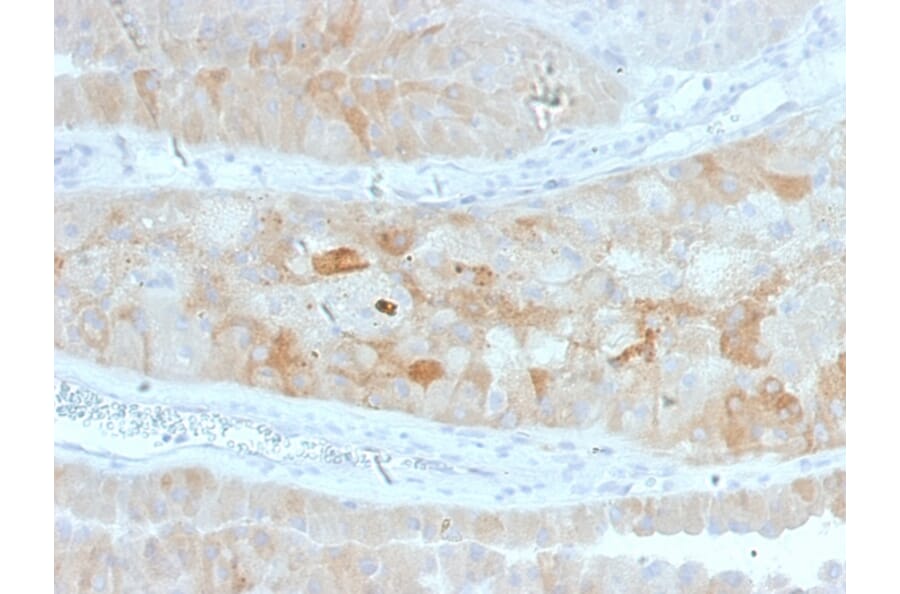 Immunohistochemistry - Anti-ROR2 Antibody [ROR2/1912] (A249540) - Antibodies.com