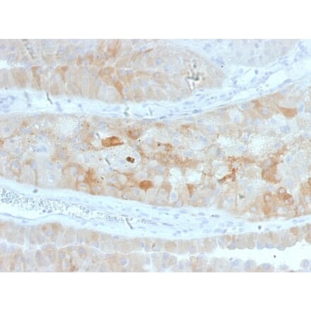 Immunohistochemistry - Anti-ROR2 Antibody [ROR2/1912] (A249540) - Antibodies.com