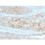 Immunohistochemistry - Anti-ROR2 Antibody [ROR2/1912] (A249540) - Antibodies.com