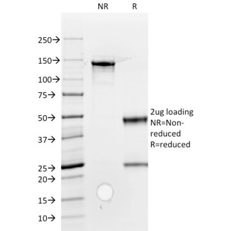 SDS-PAGE - Anti-ROR2 Antibody [ROR2/1912] (A249541) - Antibodies.com