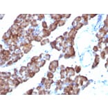 Immunohistochemistry - Anti-Ornithine Decarboxylase Antibody [ODC1/485] (A249542) - Antibodies.com