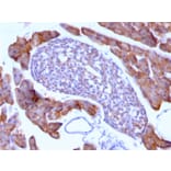 Immunohistochemistry - Anti-Ornithine Decarboxylase Antibody [ODC1/485] (A249542) - Antibodies.com