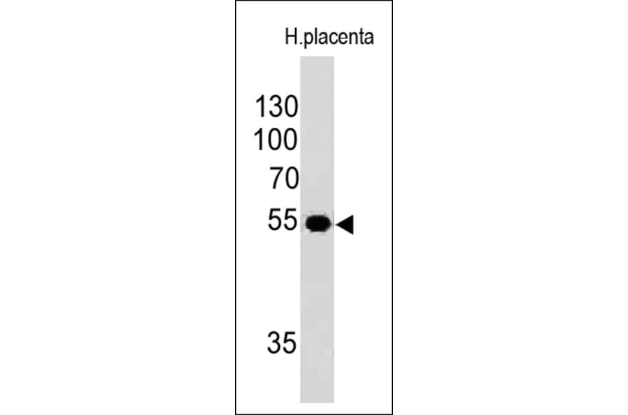Western Blot - Anti-Ornithine Decarboxylase Antibody [ODC1/485] (A249542) - Antibodies.com