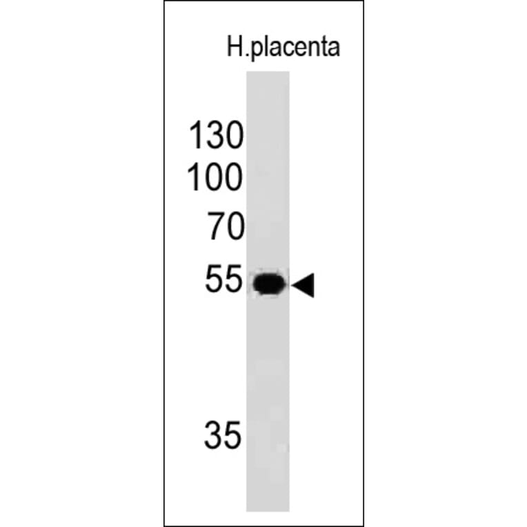 Western Blot - Anti-Ornithine Decarboxylase Antibody [ODC1/485] (A249542) - Antibodies.com