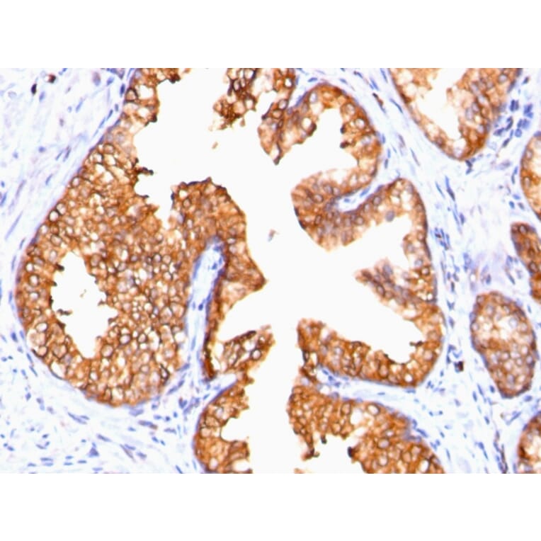 Immunohistochemistry - Anti-Ornithine Decarboxylase Antibody [ODC1/485] (A249542) - Antibodies.com