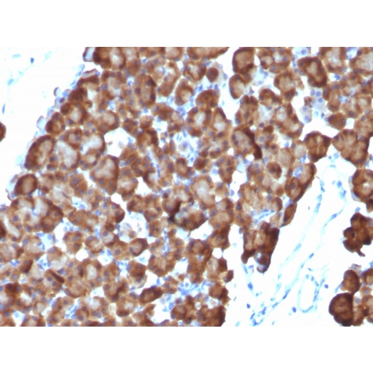 Immunohistochemistry - Anti-Ornithine Decarboxylase Antibody [ODC1/486] (A249544) - Antibodies.com