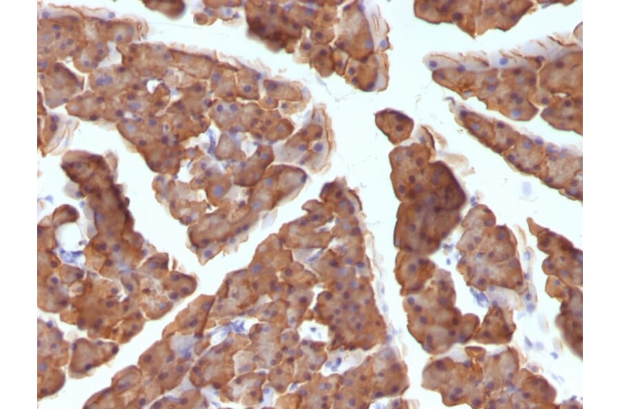 Immunohistochemistry - Anti-Ornithine Decarboxylase Antibody [ODC1/486] (A249544) - Antibodies.com