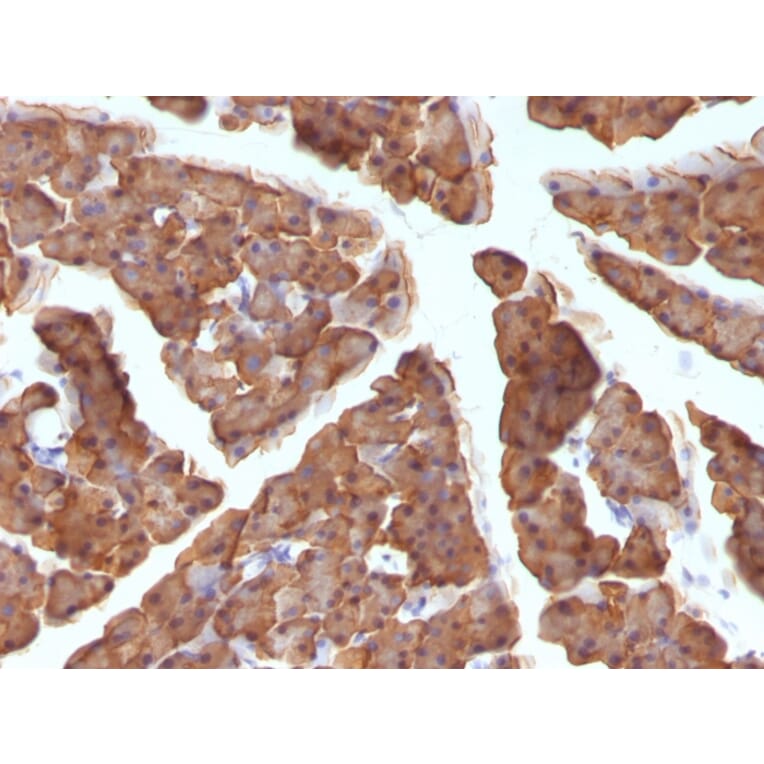 Immunohistochemistry - Anti-Ornithine Decarboxylase Antibody [ODC1/486] (A249544) - Antibodies.com