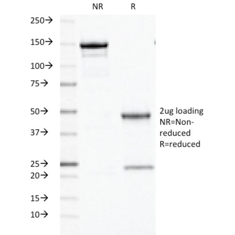 SDS-PAGE - Anti-Ornithine Decarboxylase Antibody [ODC1/486] (A249544) - Antibodies.com