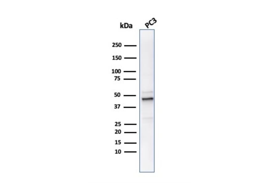 Western Blot - Anti-Ornithine Decarboxylase Antibody [ODC1/486] (A249544) - Antibodies.com