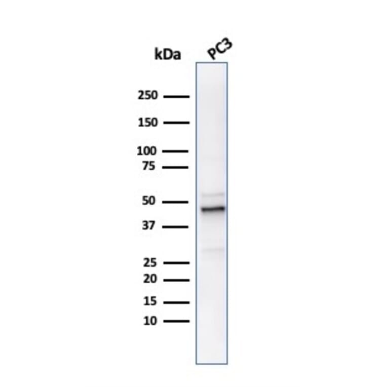 Western Blot - Anti-Ornithine Decarboxylase Antibody [ODC1/486] (A249544) - Antibodies.com