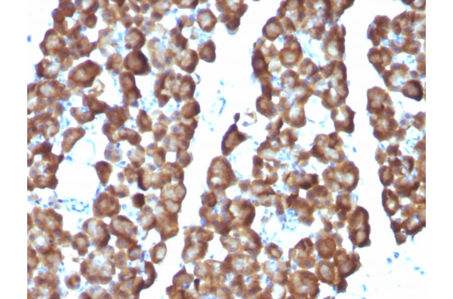 Immunohistochemistry - Anti-Ornithine Decarboxylase Antibody [ODC1/487] (A249545) - Antibodies.com
