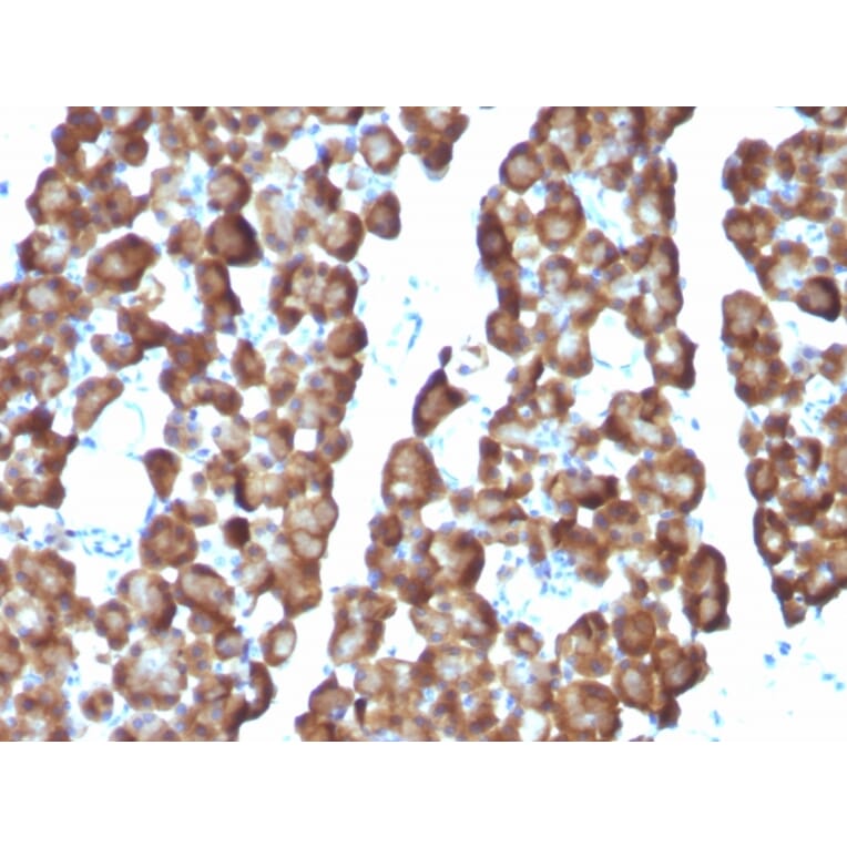 Immunohistochemistry - Anti-Ornithine Decarboxylase Antibody [ODC1/487] (A249545) - Antibodies.com