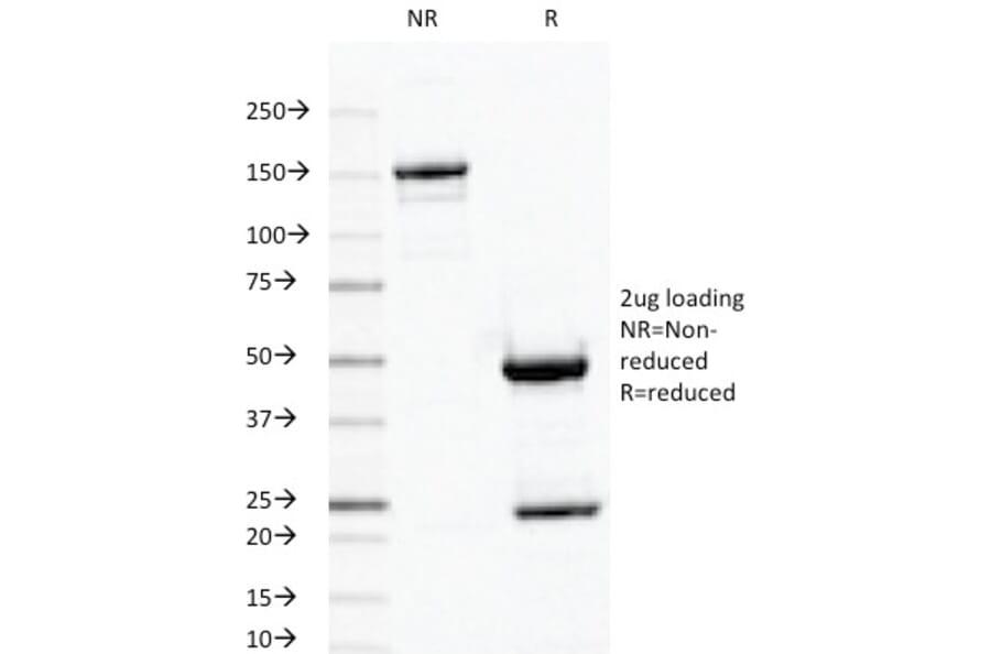 SDS-PAGE - Anti-Ornithine Decarboxylase Antibody [ODC1/487] (A249545) - Antibodies.com