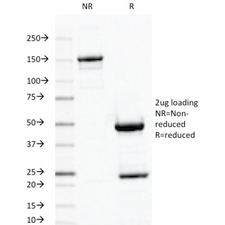 SDS-PAGE - Anti-Ornithine Decarboxylase Antibody [ODC1/487] (A249545) - Antibodies.com
