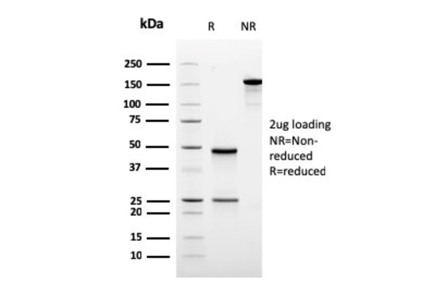 SDS-PAGE - Anti-Ornithine Decarboxylase Antibody [rODC1/485] (A249546) - Antibodies.com