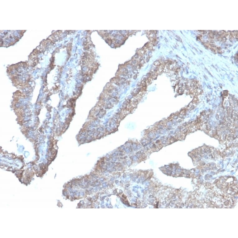 Immunohistochemistry - Anti-Ornithine Decarboxylase Antibody [rODC1/485] (A249545) - Antibodies.com