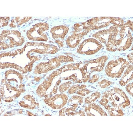 Immunohistochemistry - Anti-Ornithine Decarboxylase Antibody [ODC1/2878R] (A249546) - Antibodies.com