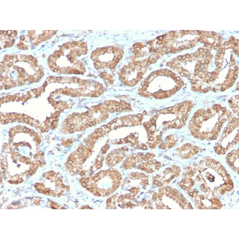 Immunohistochemistry - Anti-Ornithine Decarboxylase Antibody [ODC1/2878R] (A249546) - Antibodies.com