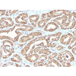 Immunohistochemistry - Anti-Ornithine Decarboxylase Antibody [ODC1/2878R] (A249546) - Antibodies.com