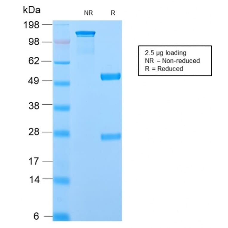 SDS-PAGE - Anti-Ornithine Decarboxylase Antibody [ODC1/2878R] (A249547) - Antibodies.com