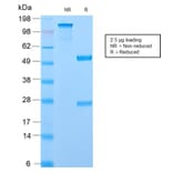 SDS-PAGE - Anti-Ornithine Decarboxylase Antibody [ODC1/2878R] (A249547) - Antibodies.com