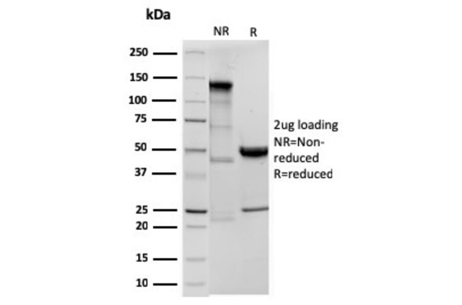 SDS-PAGE - Anti-Ornithine Decarboxylase Antibody [ODC1/3636R] (A249548) - Antibodies.com
