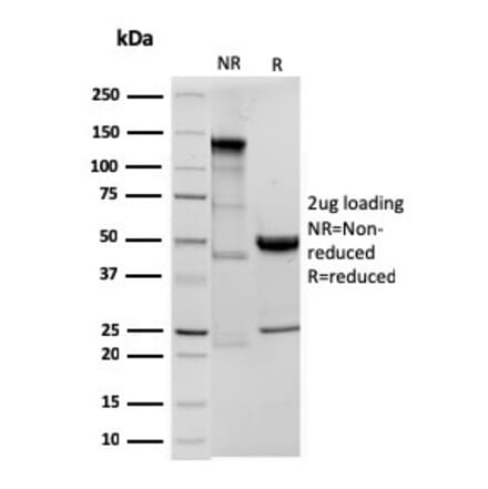 SDS-PAGE - Anti-Ornithine Decarboxylase Antibody [ODC1/3636R] (A249548) - Antibodies.com