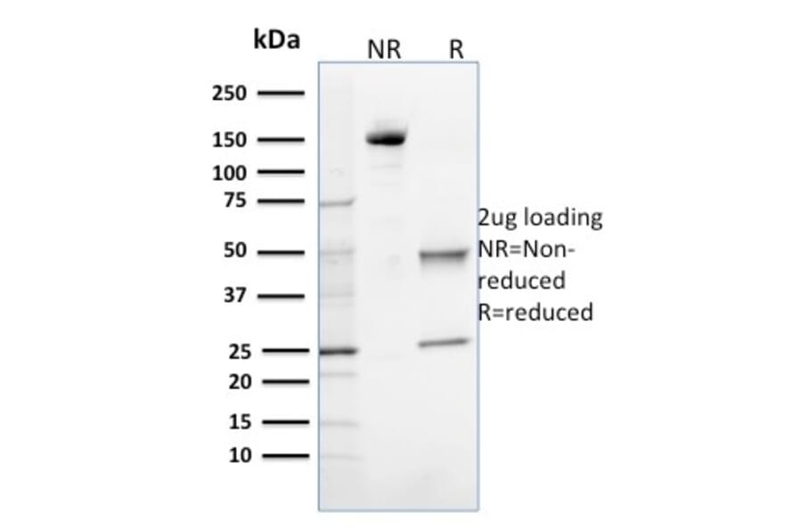 SDS-PAGE - Anti-OGG1 Antibody [CPTC-OGG1-1] (A249549) - Antibodies.com