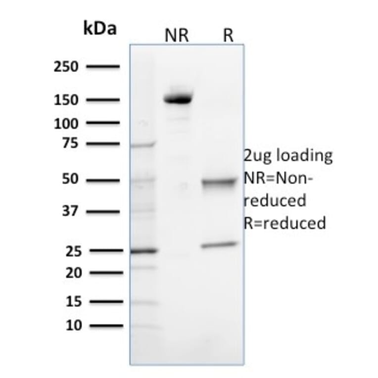 SDS-PAGE - Anti-OGG1 Antibody [CPTC-OGG1-1] (A249549) - Antibodies.com