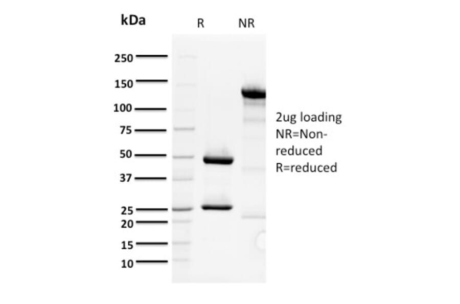 SDS-PAGE - Anti-ORC1 Antibody [7F6/1] (A249549) - Antibodies.com