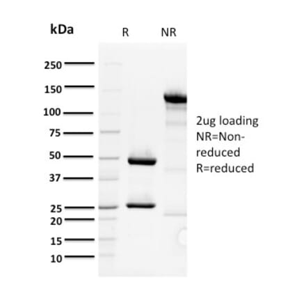 SDS-PAGE - Anti-ORC1 Antibody [7F6/1] (A249549) - Antibodies.com