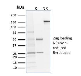 SDS-PAGE - Anti-Langerin Antibody [LGRN/1821] (A249551) - Antibodies.com