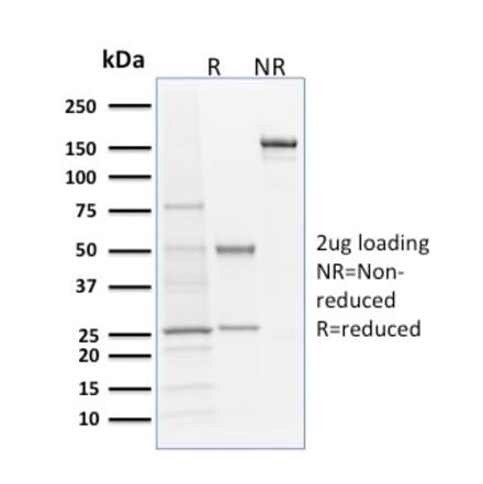 SDS-PAGE - Anti-Langerin Antibody [LGRN/1821] (A249551) - Antibodies.com