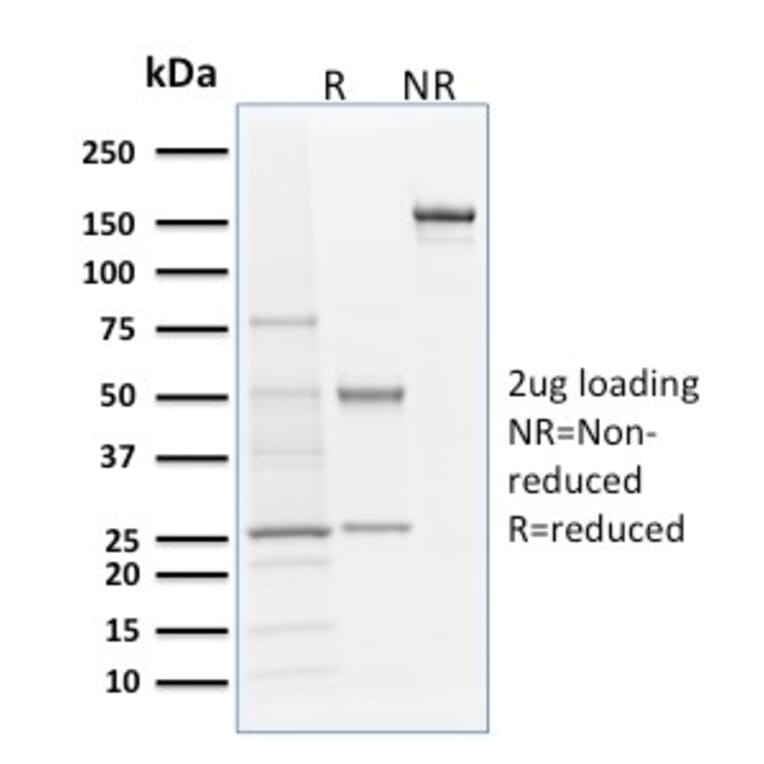 SDS-PAGE - Anti-Langerin Antibody [LGRN/1821] (A249551) - Antibodies.com