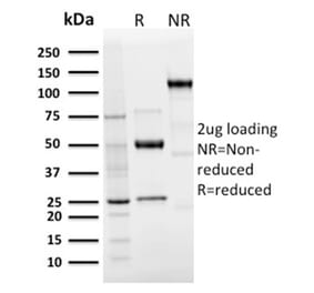 SDS-PAGE - Anti-Langerin Antibody [LGRN/3136R] (A249552) - Antibodies.com
