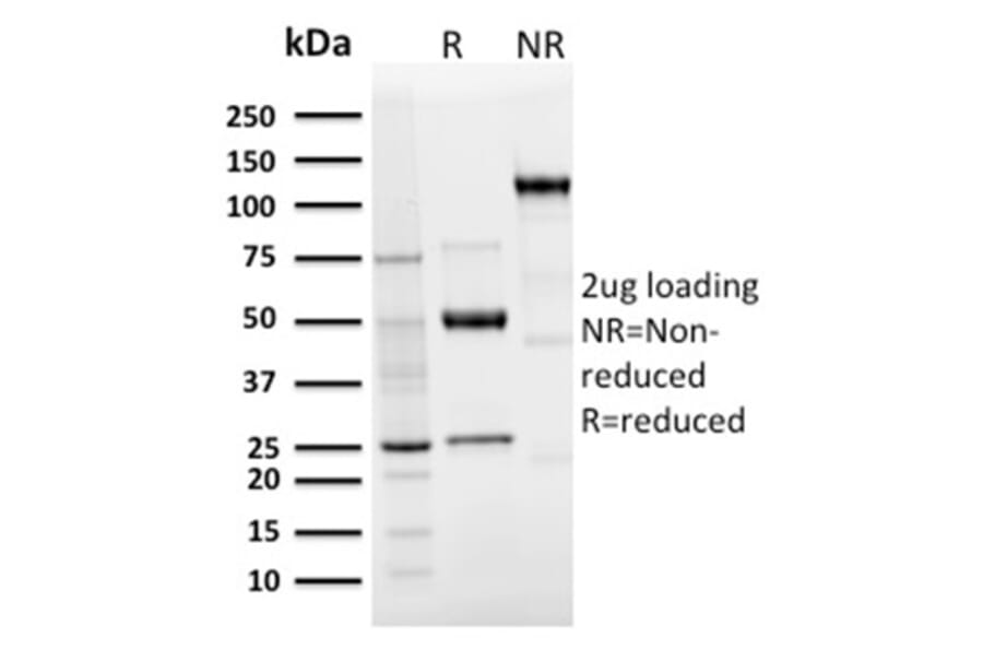 SDS-PAGE - Anti-Langerin Antibody [LGRN/3136R] (A249552) - Antibodies.com