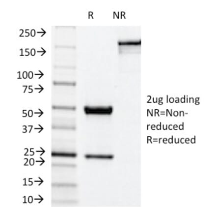 SDS-PAGE - Anti-NADPH Oxidase 4 Antibody [NOX4/1245] (A249553) - Antibodies.com