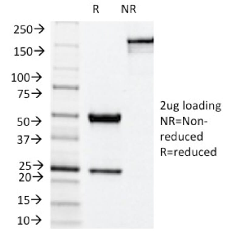 SDS-PAGE - Anti-NADPH Oxidase 4 Antibody [NOX4/1245] (A249553) - Antibodies.com