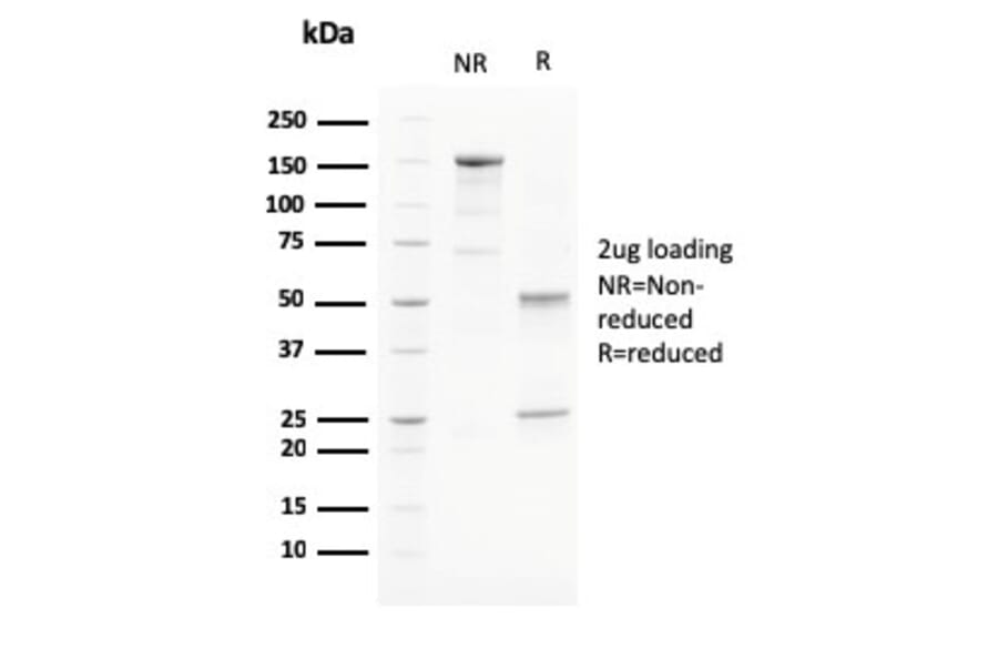 SDS-PAGE - Anti-PAPP A Antibody [PAPPA/2715] (A249555) - Antibodies.com