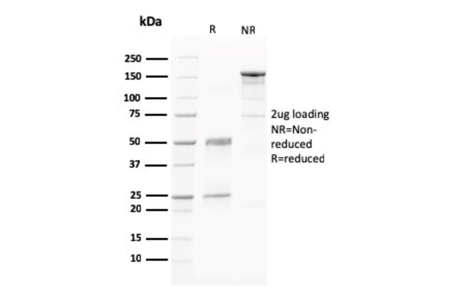 SDS-PAGE - Anti-PAPP A Antibody [PAPPA/2716] (A249556) - Antibodies.com