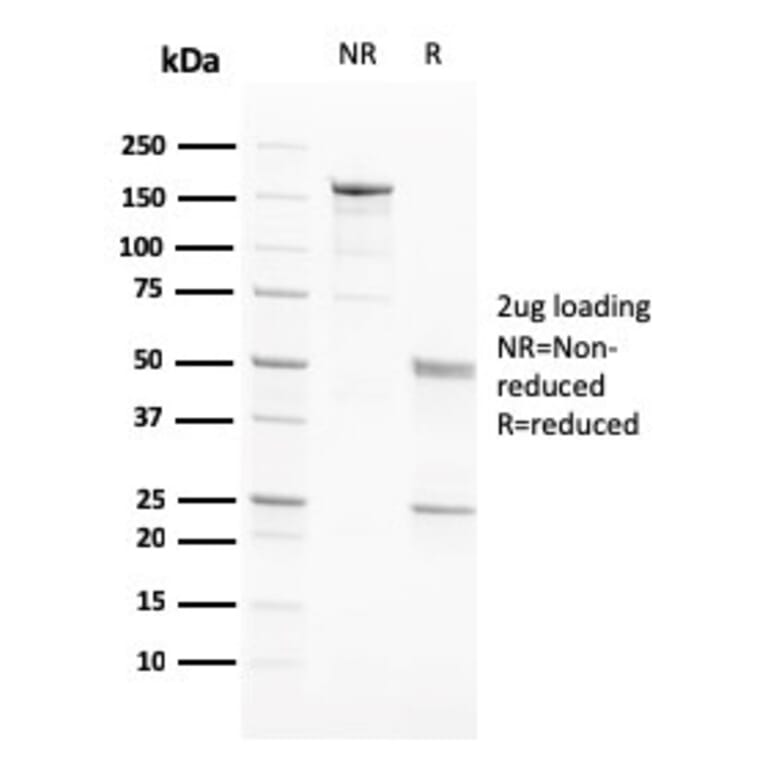 SDS-PAGE - Anti-PAPP A Antibody [PAPPA/2717] (A249557) - Antibodies.com