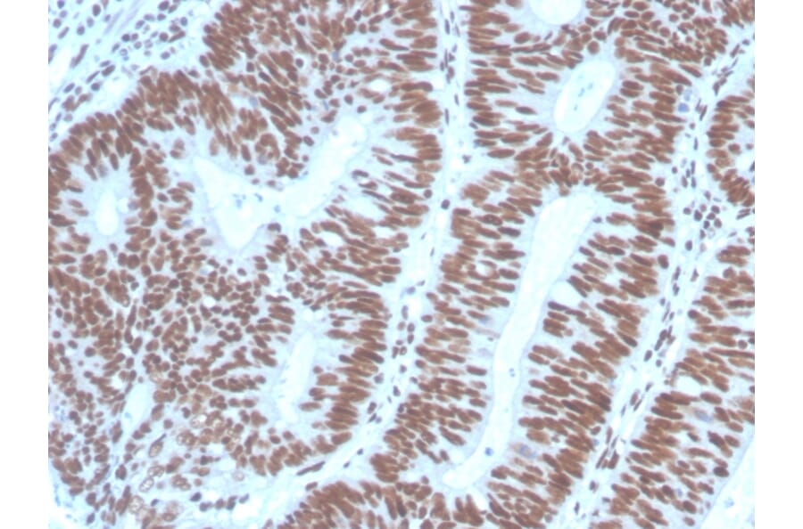Immunohistochemistry - Anti-PAX2 Antibody [PAX2/1104] (A249559) - Antibodies.com